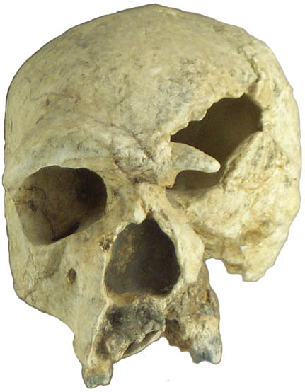 Steinheim Skull