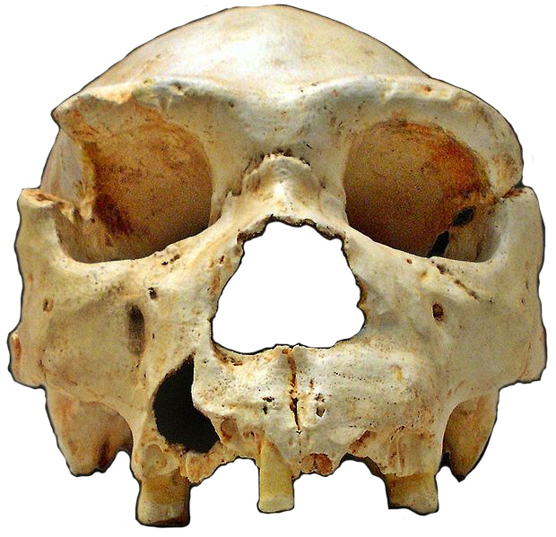 Skull 5 (Miguelón)