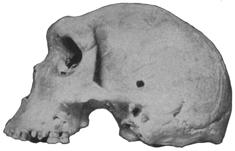 Broken Hill 1 (Kabwe Cranium or Rhodesian Man)