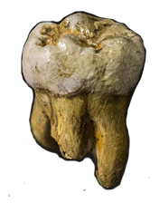 Denisovan tooth